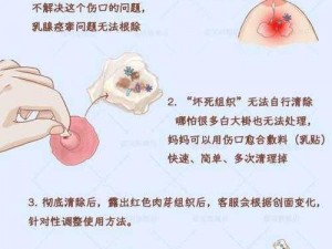 为什么我的奶头被吃得又翘又肿？如何缓解这种不适？