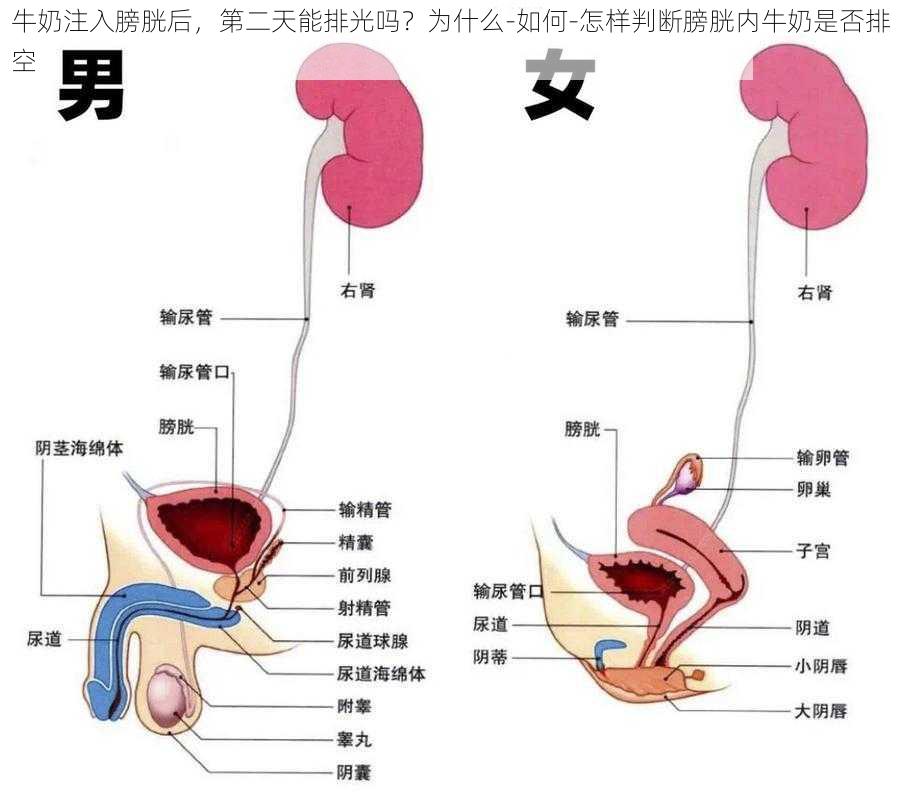 牛奶注入膀胱后，第二天能排光吗？为什么-如何-怎样判断膀胱内牛奶是否排空